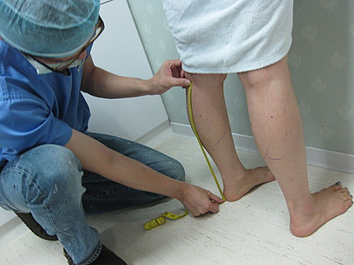 Chân đẹp, dáng thon cùng công nghệ giảm mỡ bắp chân Body Laser